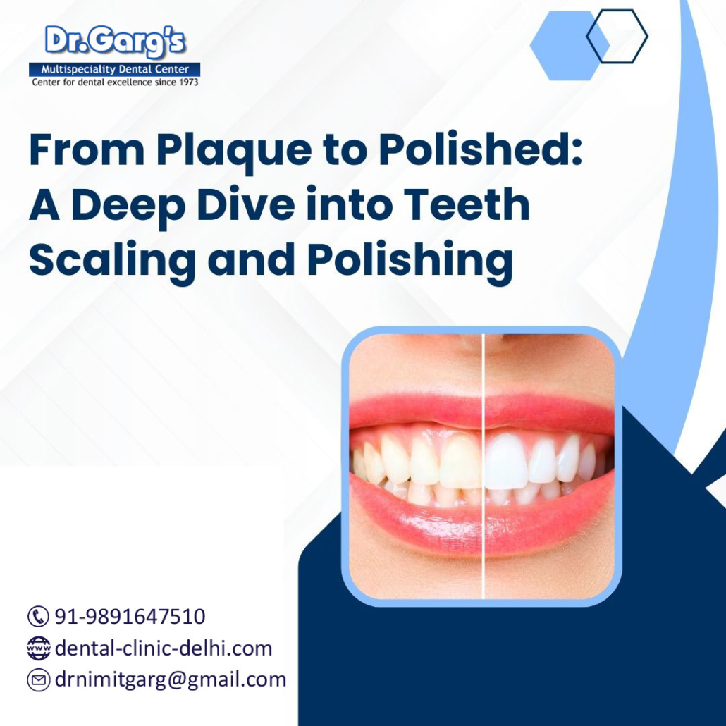 TeethScalingandPolishinginDelhi