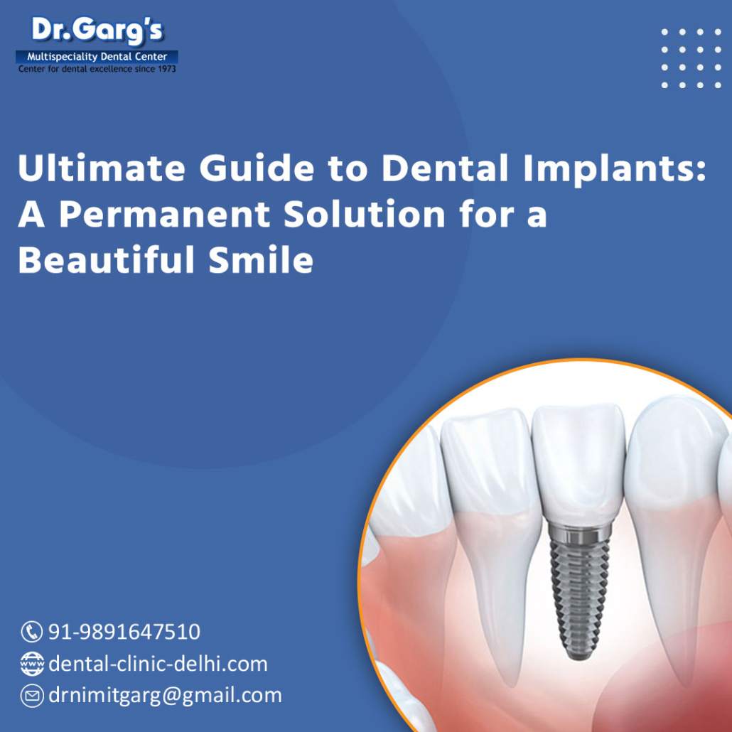 Dental implants at Dr. Garg’s Multispeciality Dental Center
