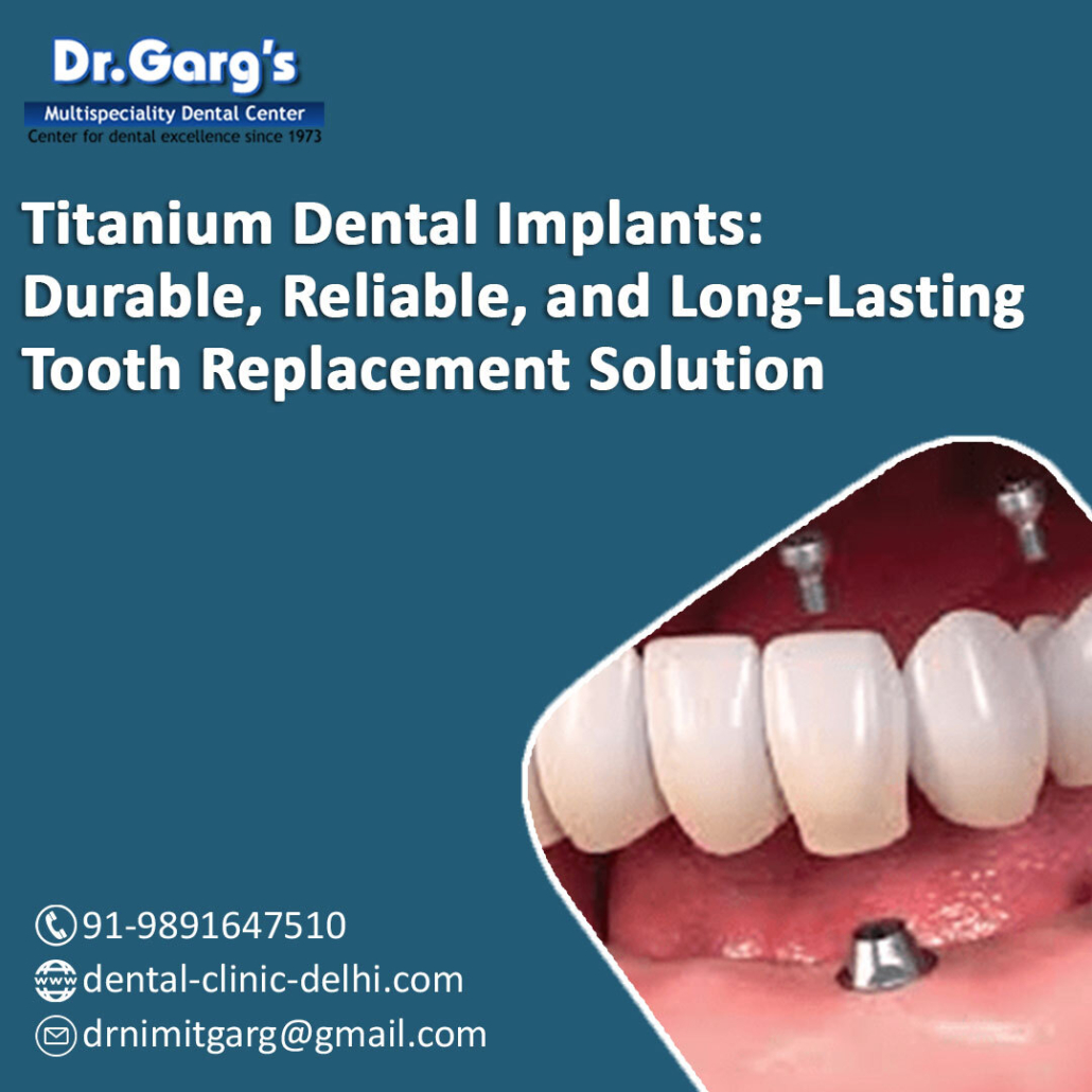 Titanium Dental Implants stand out for their strength, compatibility with bone, and long-term success. 