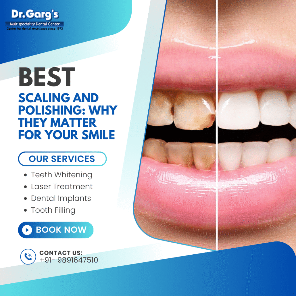 before and after scaling teeth