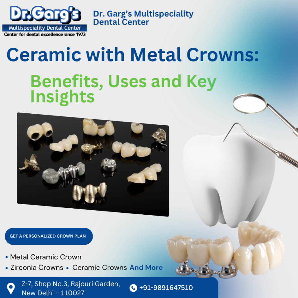 Ceramic with Metal Crowns also known as a metal ceramic dental crown